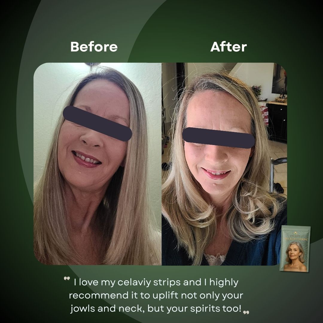 Celaviy™ Secret NeckLift Strips