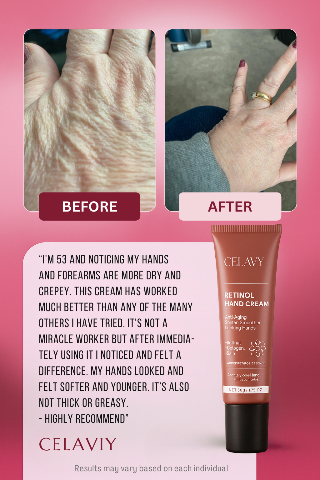 Celaviy® Advanced Hand Corrector
