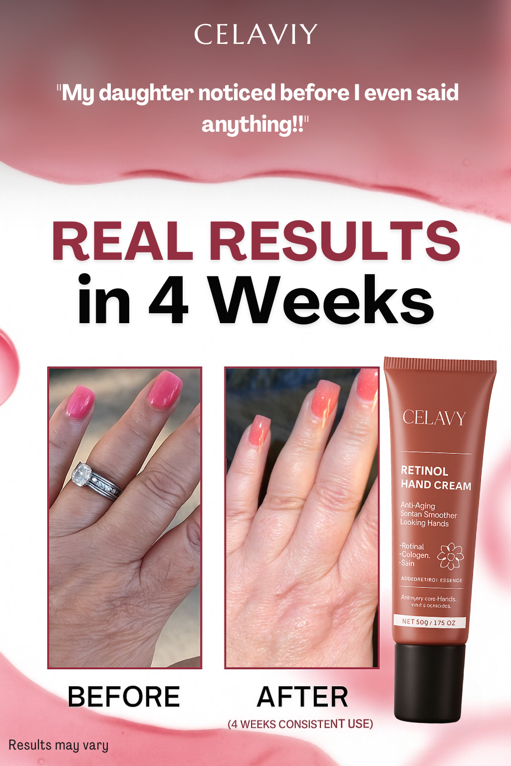 Celaviy® Advanced Hand Corrector